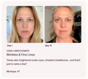 solawave radiant renewal 4 in 1