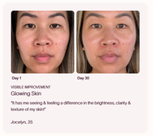 solawave radiant renewal 4 in 1