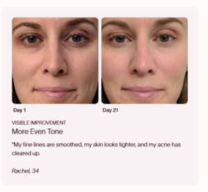 solawave radiant renewal 4 in 1